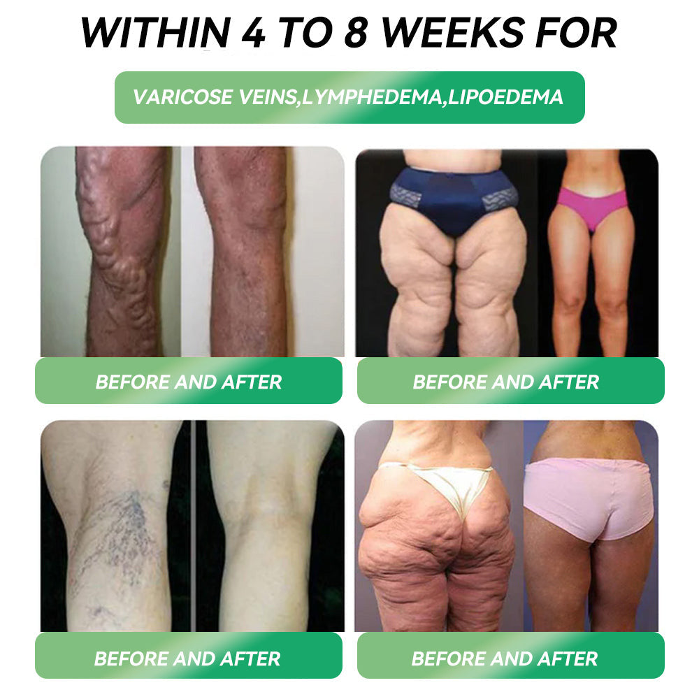 TotaI Body HeaIth Start Here | 𝖯𝗂𝗀𝗎𝗂𝖺𝗒® 𝖦𝖫𝖯-𝟣 𝖶𝖾𝗂𝗀𝗁𝗍 𝖫𝗈𝗌𝗌 𝖮𝗋𝖺𝗅 𝖲𝗈𝗅𝗎𝗍𝗂𝗈𝗇 – 𝖮𝖻𝖾𝗌𝗂𝗍𝗒, 𝖢𝖺𝗋𝖽𝗂𝗈𝗏𝖺𝗌𝖼𝗎𝗅𝖺𝗋 𝖣𝗂𝗌𝖾𝖺𝗌𝖾𝗌, 𝖣𝗂𝖺𝖻𝖾𝗍𝖾𝗌, 𝖲𝗅𝖾𝖾𝗉 𝖠𝗉𝗇𝖾𝖺, 𝖩𝗈𝗂𝗇𝗍 𝖯𝗋𝗈𝖻𝗅𝖾𝗆𝗌 𝖺𝗇𝖽 𝖬𝗈𝗋𝖾📺